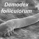 Demodex Mites: Link to Chronic Dry Eye Explained