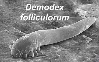 Demodex Mites: Link to Chronic Dry Eye Explained