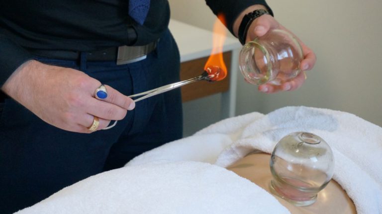 Cupping Therapy: Discover Melbourne’s Healing Benefits Now
