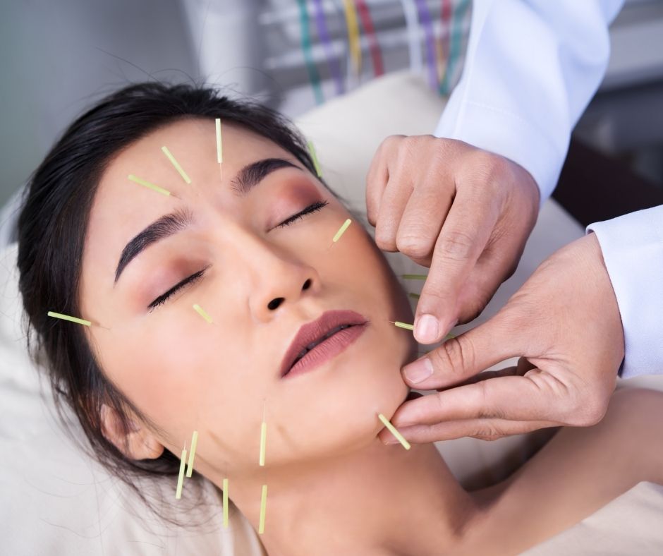 Facial Acupuncture